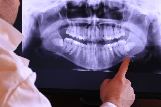 Best Emergency Dental Surgery in East Bethel, MN