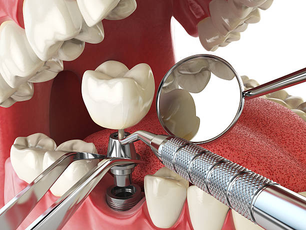 Best After-Hours Emergency Dentist in East Bethel, MN